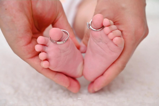 赵县孕妇怎样预防妊娠纹